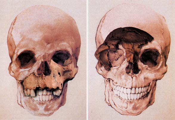 Atapuerca Skull